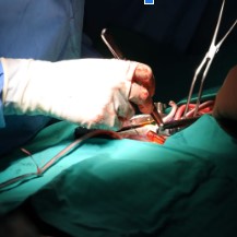 Imagen Enfermeros puertomontinos se capacitan en HGGB en cardiocirugía